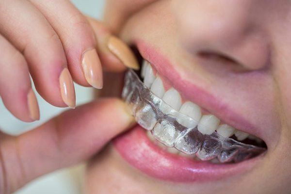 Img 19epbs dental.jpg 2 1 8iakranb.jpg