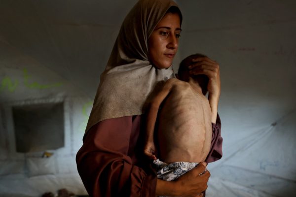 Afp 20250724 67pu7t6 v4 highres topshotpalestinianisraelconflictmalnutrition 1753599810.jpg