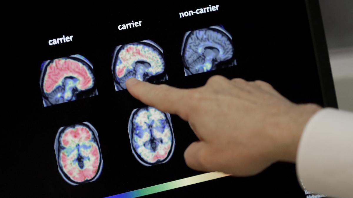 Be well shingles vaccine dementia 83387.jpg